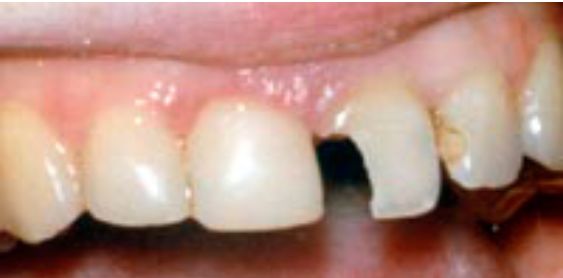 СТОМАТОЛОГІЧНИЙ ВІДДІЛ УНІВЕРСИТЕТСЬКОЇ КЛІНІКИ