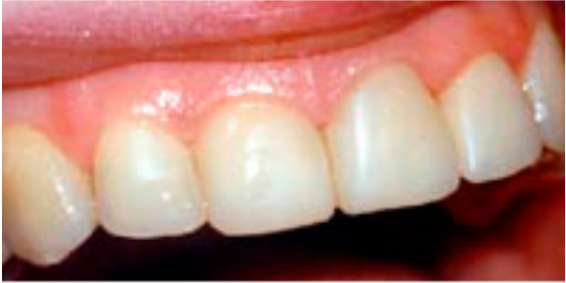 СТОМАТОЛОГІЧНИЙ ВІДДІЛ УНІВЕРСИТЕТСЬКОЇ КЛІНІКИ