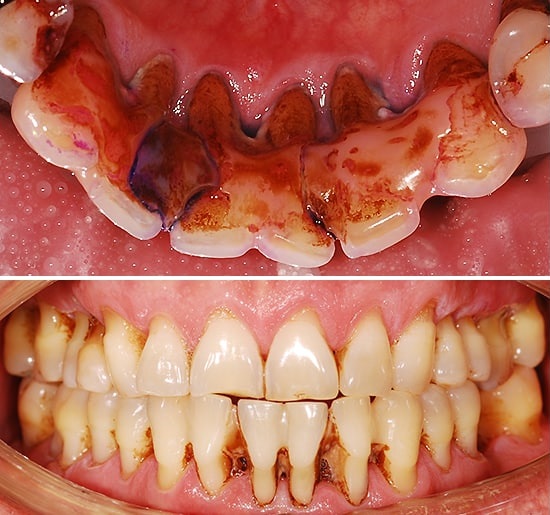 СТОМАТОЛОГІЧНИЙ ВІДДІЛ УНІВЕРСИТЕТСЬКОЇ КЛІНІКИ