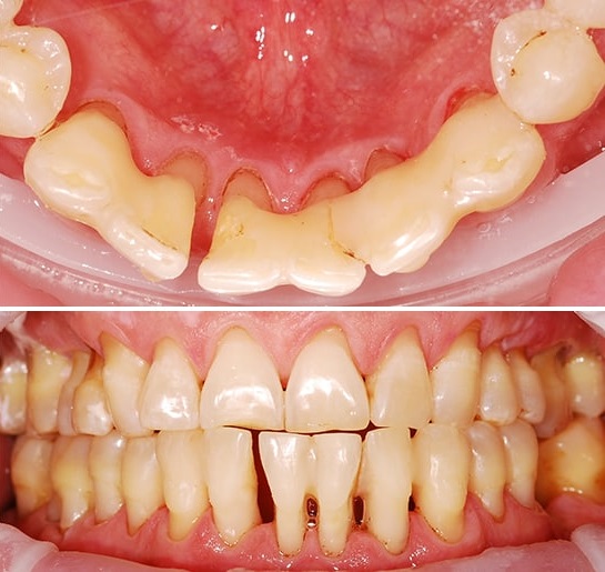 СТОМАТОЛОГІЧНИЙ ВІДДІЛ УНІВЕРСИТЕТСЬКОЇ КЛІНІКИ