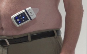 6.subcutaneous furosemide